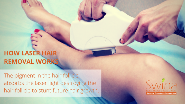 SWINA blog photo template_laser hair removal (1).png